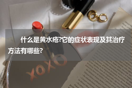 　　什么是黄水疮?它的症状表现及其治疗方法有哪些?